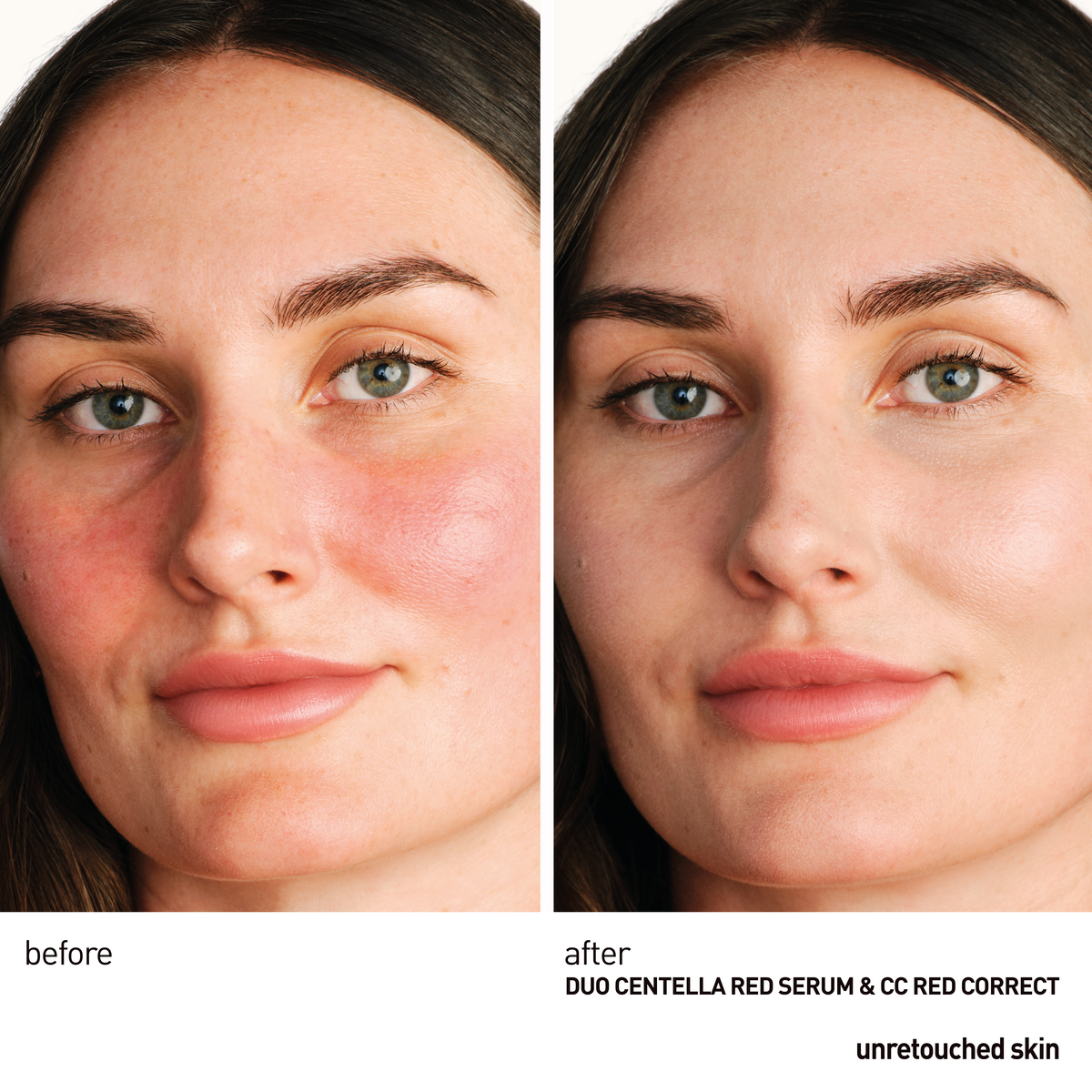 Centella Red Serum Mini (10ml)