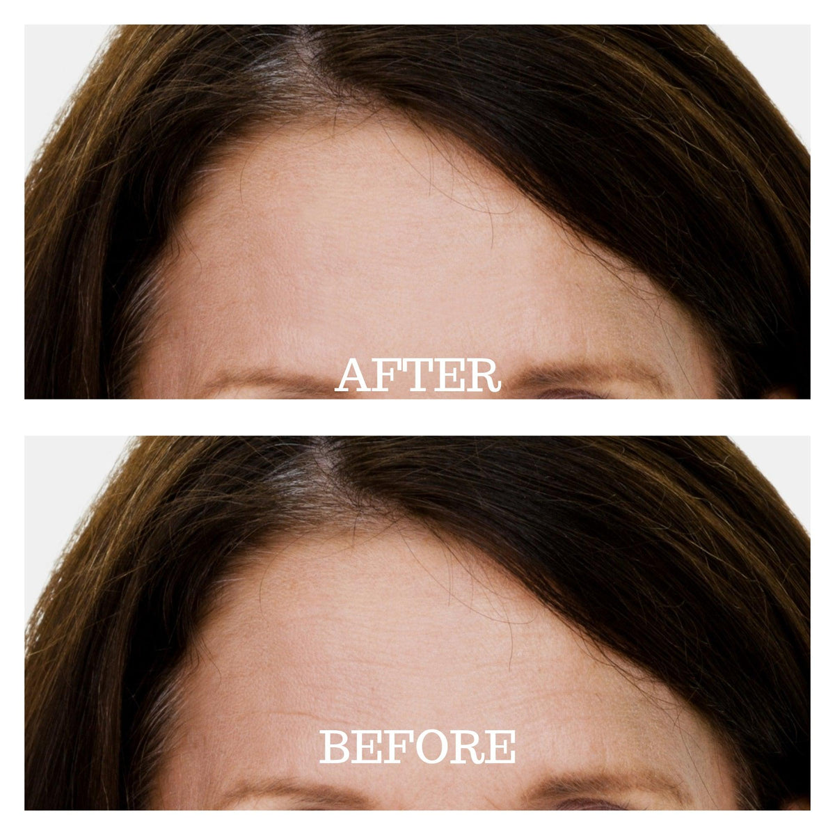 Forehead Wrinkle Patch | Reusable Skin Plumping Forehead Mask